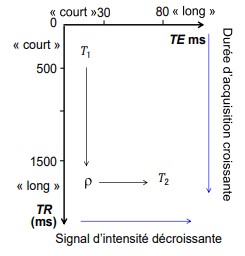 Pondération IRM.jpg