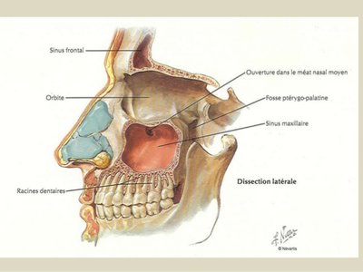sinus-maxillaire-8-638.jpg
