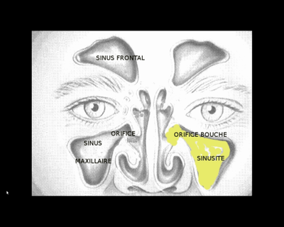 méat sinusaux.png