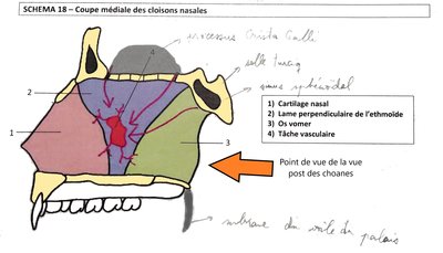 Vue médiane fosses nasales.jpg