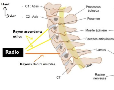 rayons ascendants.jpg