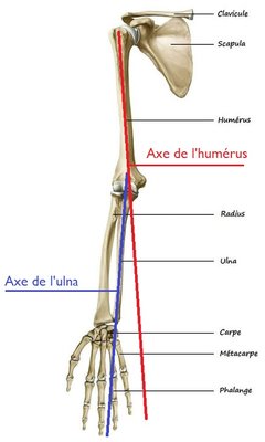 ulna déportée.jpg