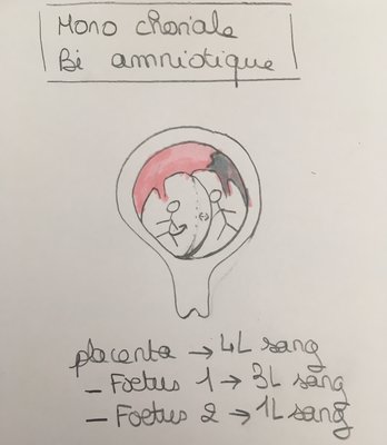 bi amnioique.jpg (1.14 Mio) Vu 526 fois bi amnioique.jpg