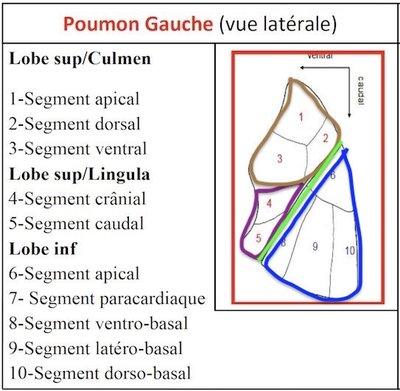 exploration_radiologique_poumon_2_1 2.jpeg