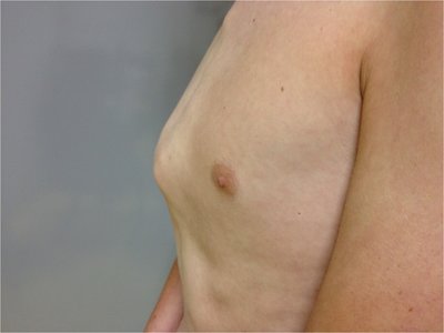 plexus carinatum.jpg