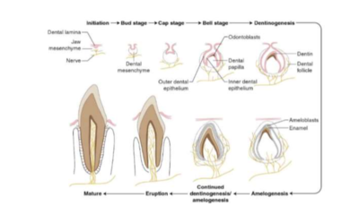 sensibilité dentinaire.png