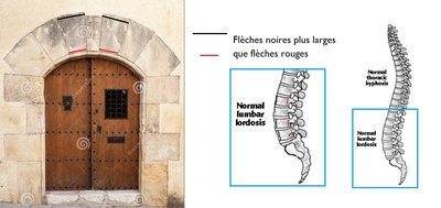 lordose lombaire voute.jpg