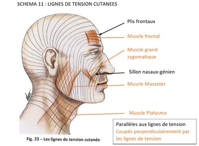 lignes de tensions.jpg