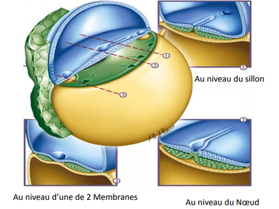 embryocoupe.png