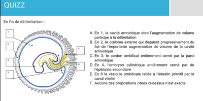 delimitation QCM.png