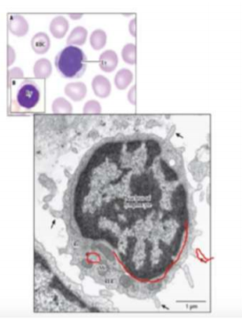 lymphocyte.png