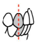 contacts occlusaux.png