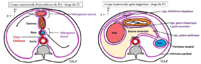 Rotation estomac.PNG