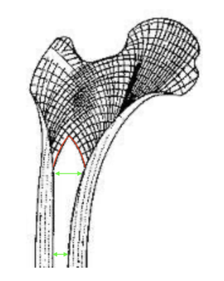 Structure ogivale os copie.png