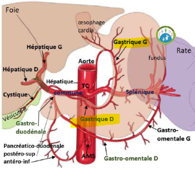 gastrique.PNG