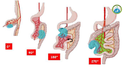 Faces mésentère.PNG