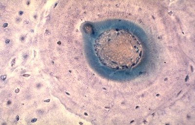 un ostéone encore + développé.jpg