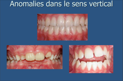 mastication image1.PNG