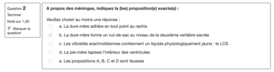 Capture d’écran 2021-04-24 à 19.05.14.png (110.15 Kio) Vu 638 fois Capture d’écran 2021-04-24 à 19.05.14.png