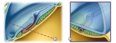 Capture d’écran 2021-11-17 200856.png