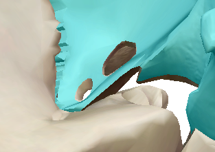 Epine sphénoïde.png