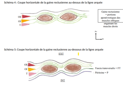 coupe horizontale gaine rectusienne.png