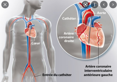 Capture d’écran 2022-03-02 à 17.23.00.png
