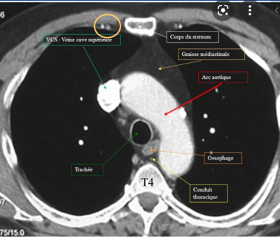 Capture d’écran 2022-03-23 à 15.05.52.png