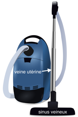 1200px-Blue_vacuum_cleaner.svg.png