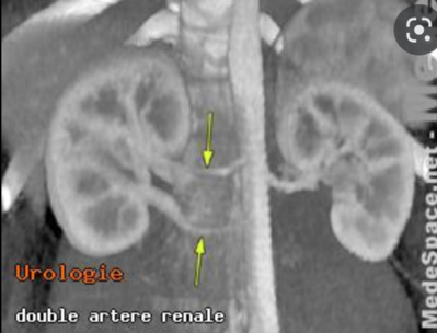 Capture d’écran 2022-04-18 à 16.25.19.png