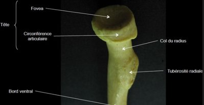 tete radius.jpg