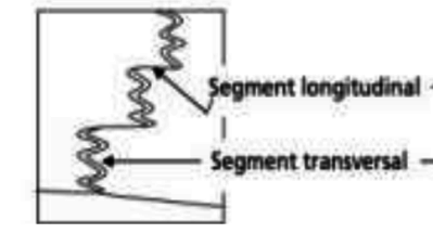 reponse demi strie Z.png