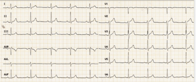 Capture d’écran 2022-11-09 à 14.31.53.png