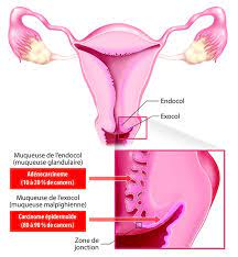 schéma utérus.jpeg
