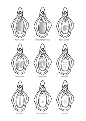 424px-Hymen_fr.png