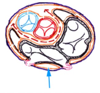 Capture d’écran 2 récessus transverse de theile main chirurgien.jpg