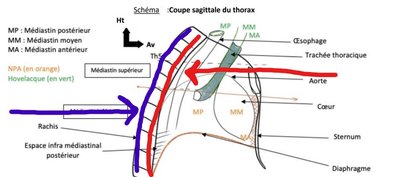 Capture cyphose thoracique concave convexe.jpg