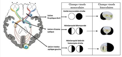 ODS - Capture 15.2.jpg