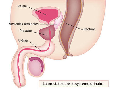 prostate_img1.jpg