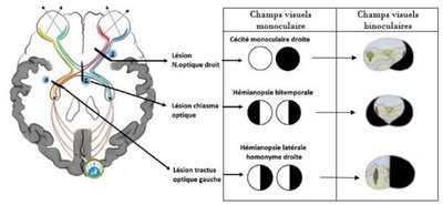 Schéma recap pathos optiques.jpg