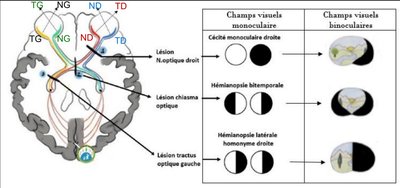 RECAP voies optiques.jpg