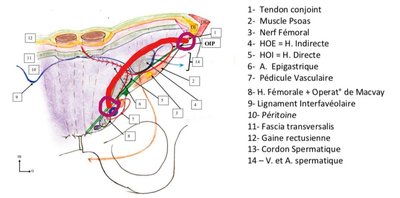 Schéma supermoche tendon conjoint.jpg