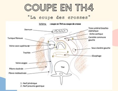 Coupe en Th4 nerf vague gauche.jpg