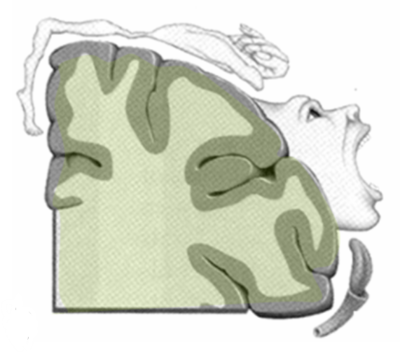 Homonculus moteur.png