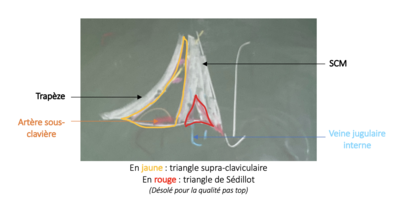 Schéma comparatif des deux triangles.png
