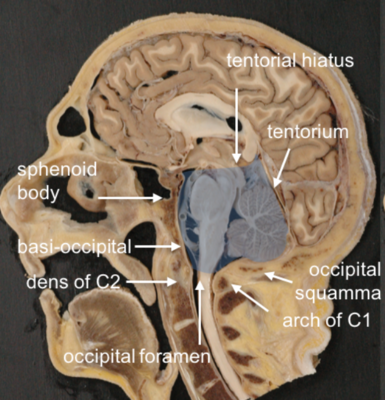 Tente du cervelet.png