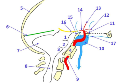 Chicane carotide int.png