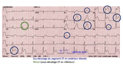 Screenshot 2023-10-24 at 23.42.00.png