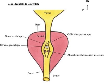 Abouchements 2 canaux éjaculateurs et utricule prostatique.jpg