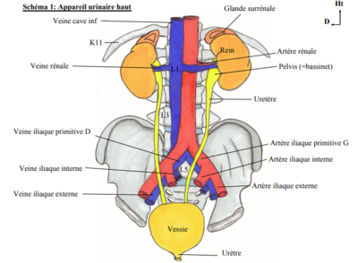 Vsx iliaques croisés par ureteres.png